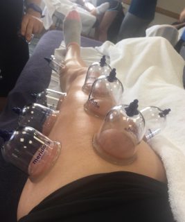 dryCupping2