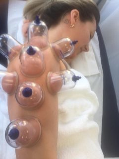 dryCupping3